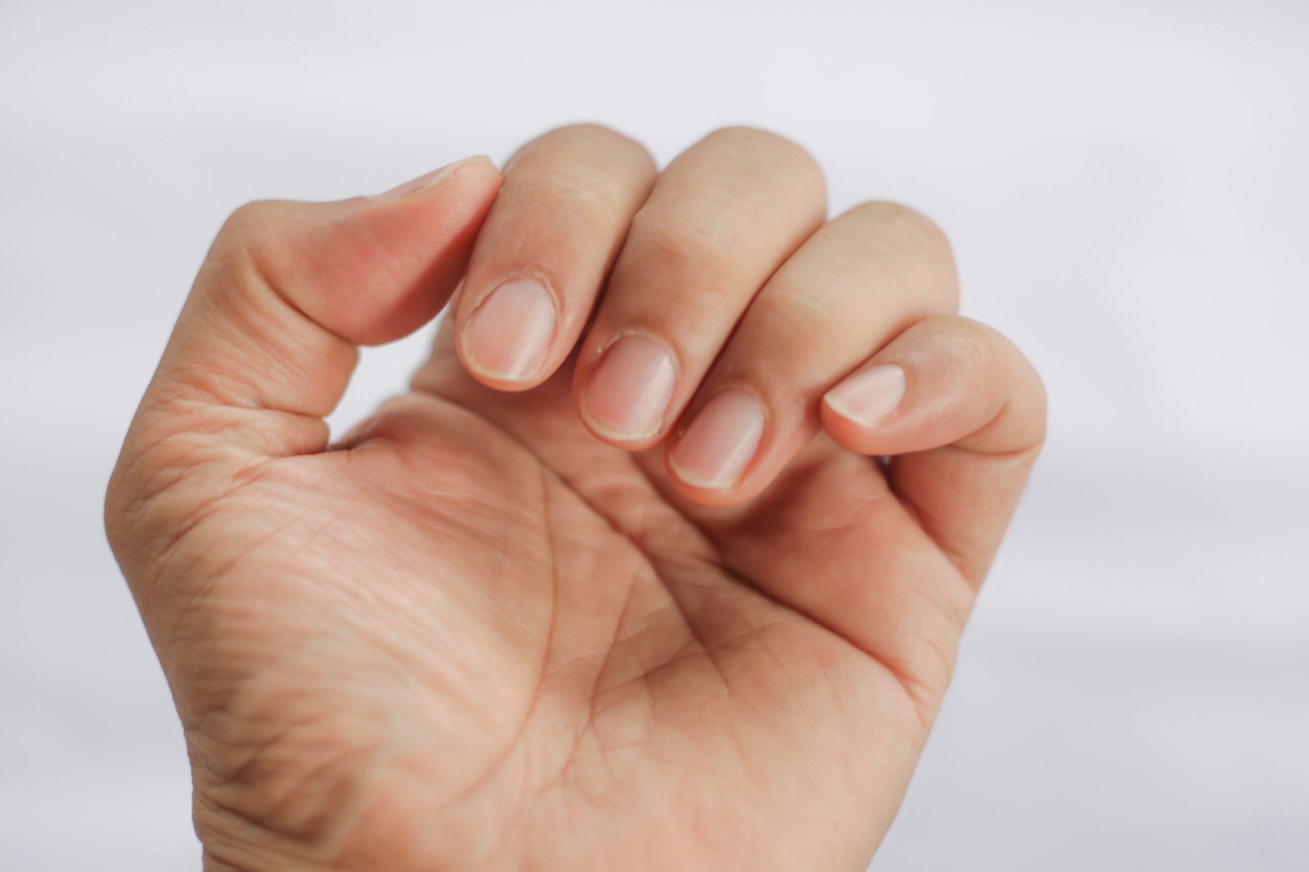 Какие должны быть ногти у здорового человека